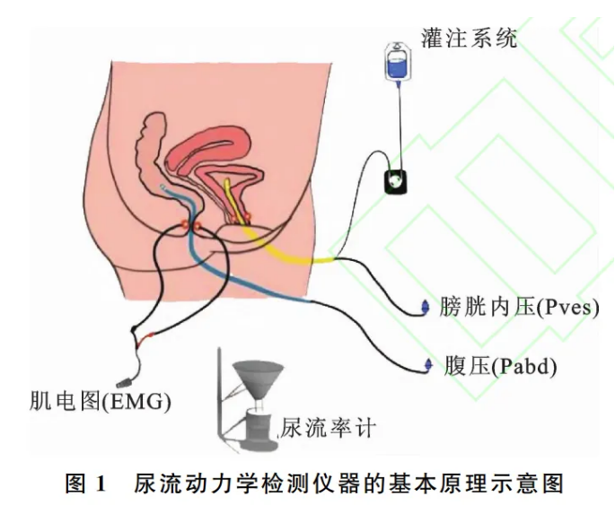 综述 | 尿流动力学检测仪器的历史、现状及展望